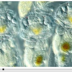 Pierwsza nagroda (link do video poniżej): kolonia wrotków. Wyraźnie widoczne przyoczka i wieniec rzęsków. Technika: mikroskop interferencyjny z kontrastem interferencyjno-różniczkowym (Nomarski interference contrast); powiększenie 200x-500x. Autor: Ralph Grimm, Jimboomba, Queensland, Australia. 