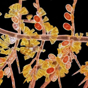 Druga nagroda: krasnorost z gatunku scagelia. Można zaobserwować komórki rozrodcze tetraspory i pozłacane okrzemki. Technika: oświetlenie w ciemnym polu. Autor: Arlene Wechezak, Anacortes, Waszyngton, USA.